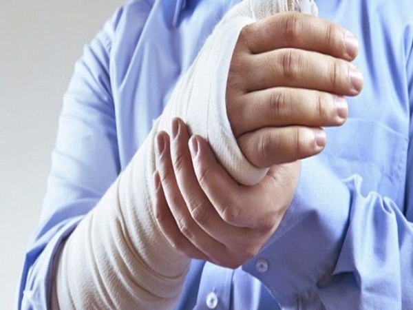 Nằm mơ thấy gãy tay là điềm gì, có số gì lộc phát?